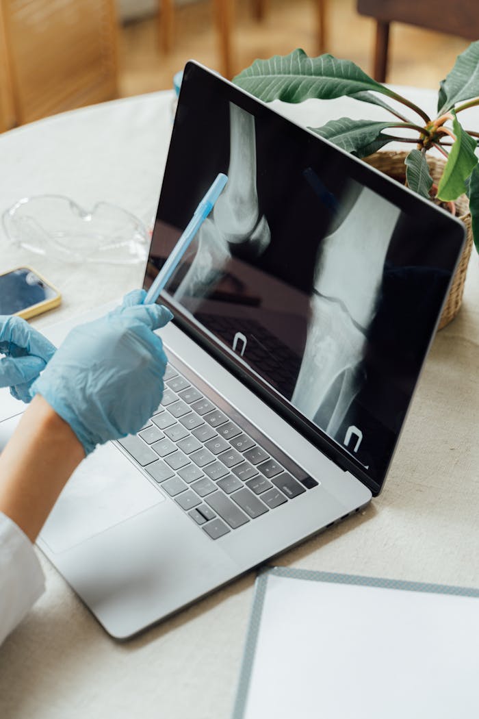 ours-journey Doctor wearing gloves examines bone X-ray on laptop in a clinical setting.
